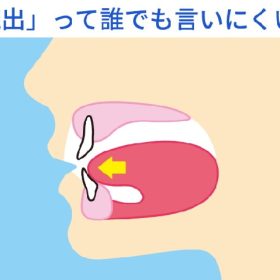 「続出」の発音の分析。