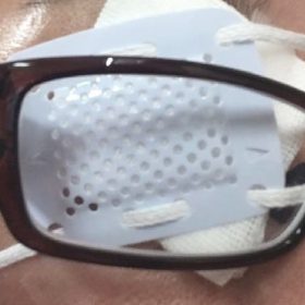 目の手術した後の片目でボイストレーニングのレッスンはつらい。