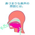 鼻声の原因。