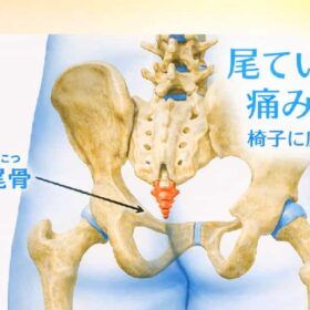 尾てい骨の痛みが座る姿勢整えて消えた