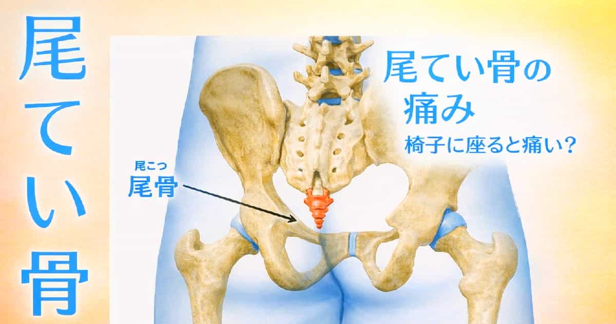尾てい骨の痛みが座る姿勢整えて消えた